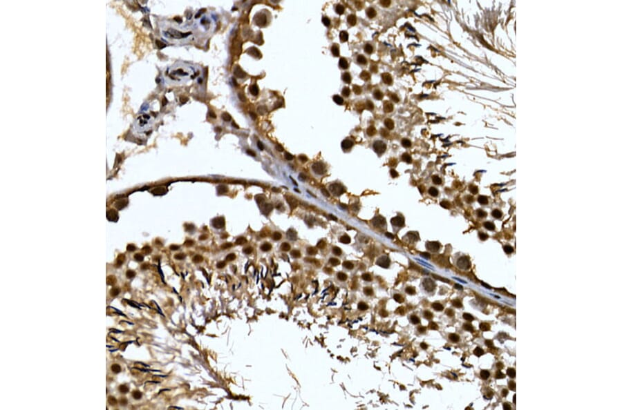 Immunohistochemistry - Anti-ZNF384 Antibody (A91113) - Antibodies.com