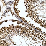 Immunohistochemistry - Anti-ZNF384 Antibody (A91113) - Antibodies.com