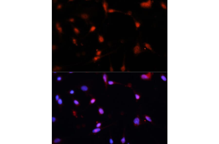 Immunofluorescence - Anti-ESR1 Antibody (A16668) - Antibodies.com