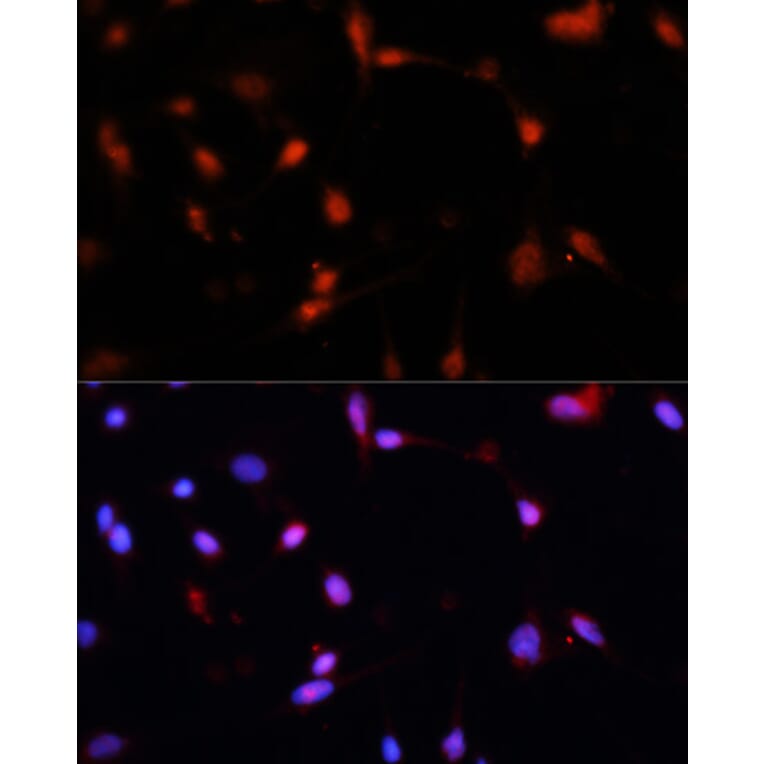 Immunofluorescence - Anti-ESR1 Antibody (A16668) - Antibodies.com