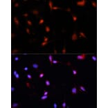 Immunofluorescence - Anti-ESR1 Antibody (A16668) - Antibodies.com