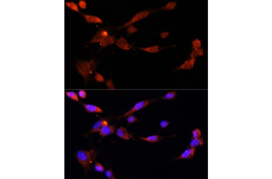 Immunofluorescence - Anti-ESR1 Antibody (A16668) - Antibodies.com
