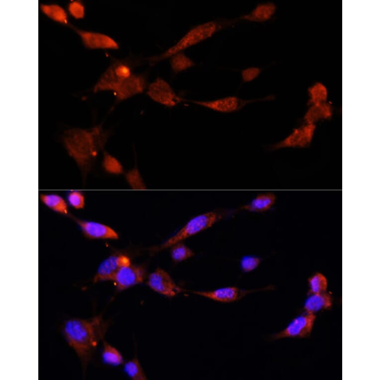 Immunofluorescence - Anti-ESR1 Antibody (A16668) - Antibodies.com
