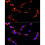Immunofluorescence - Anti-ESR1 Antibody (A16668) - Antibodies.com