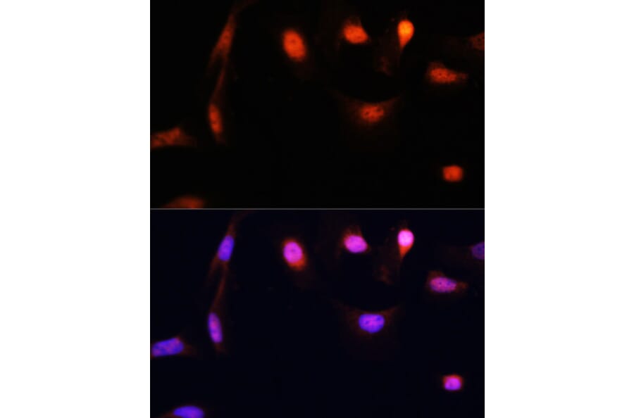 Immunofluorescence - Anti-ESR1 Antibody (A16668) - Antibodies.com