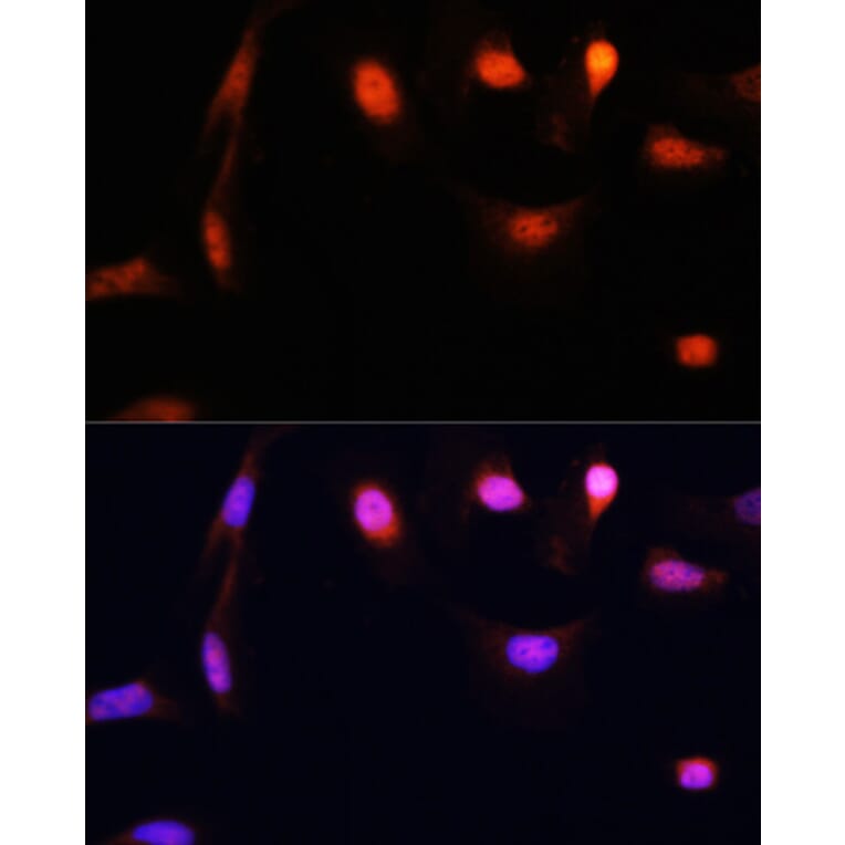Immunofluorescence - Anti-ESR1 Antibody (A16668) - Antibodies.com