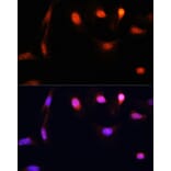 Immunofluorescence - Anti-ESR1 Antibody (A16668) - Antibodies.com