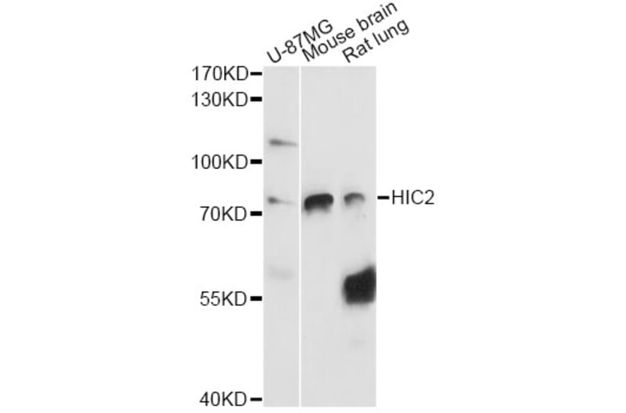 Western Blot - Anti-HIC2 Antibody (A14313) - Antibodies.com
