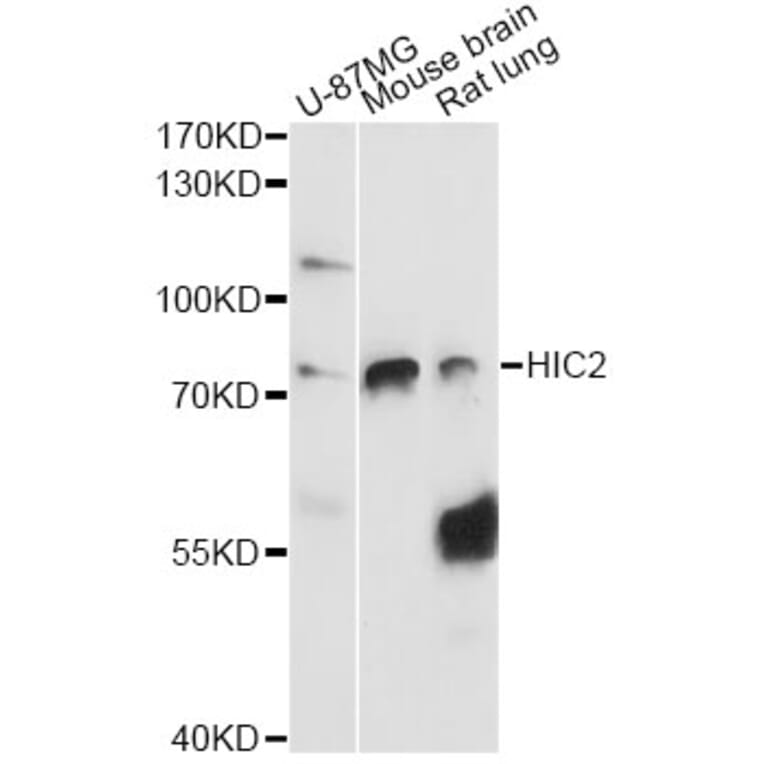 Western Blot - Anti-HIC2 Antibody (A14313) - Antibodies.com
