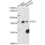 Western Blot - Anti-HIC2 Antibody (A14313) - Antibodies.com