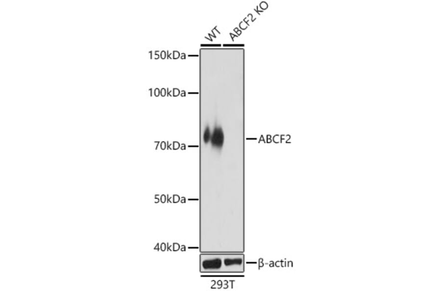 Western Blot - Anti-ABCF2 Antibody (A91118) - Antibodies.com