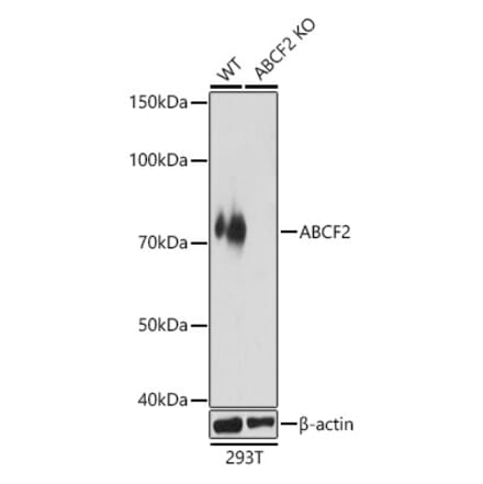 Western Blot - Anti-ABCF2 Antibody (A91118) - Antibodies.com