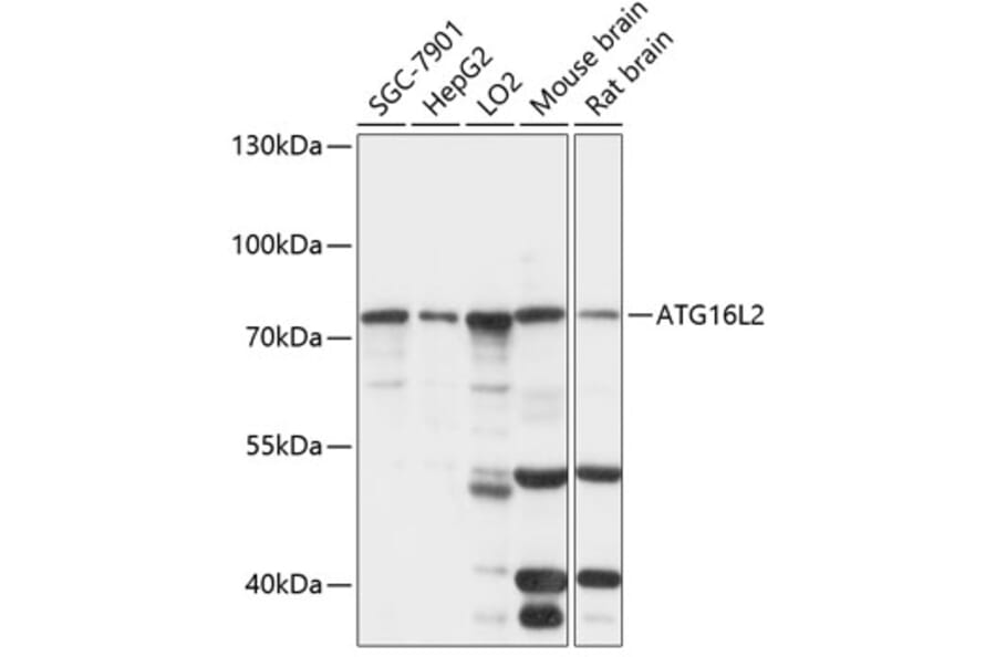 Western Blot - Anti-ATG16L2 Antibody (A91121) - Antibodies.com