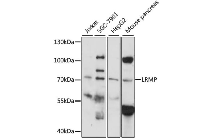 Western Blot - Anti-LRMP Antibody (A14377) - Antibodies.com