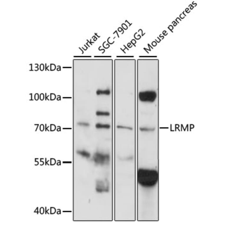 Western Blot - Anti-LRMP Antibody (A14377) - Antibodies.com