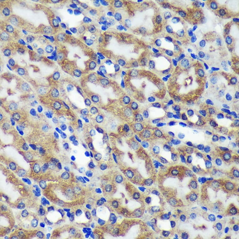 Immunohistochemistry - Anti-C18orf8 Antibody (A91124) - Antibodies.com