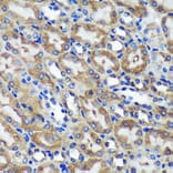 Immunohistochemistry - Anti-C18orf8 Antibody (A91124) - Antibodies.com