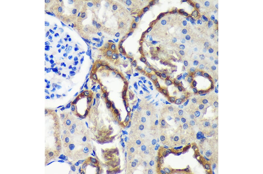 Immunohistochemistry - Anti-C18orf8 Antibody (A91124) - Antibodies.com