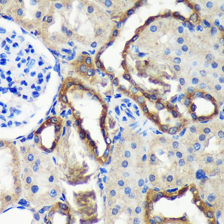Immunohistochemistry - Anti-C18orf8 Antibody (A91124) - Antibodies.com