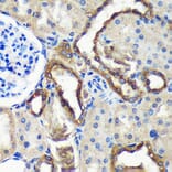 Immunohistochemistry - Anti-C18orf8 Antibody (A91124) - Antibodies.com