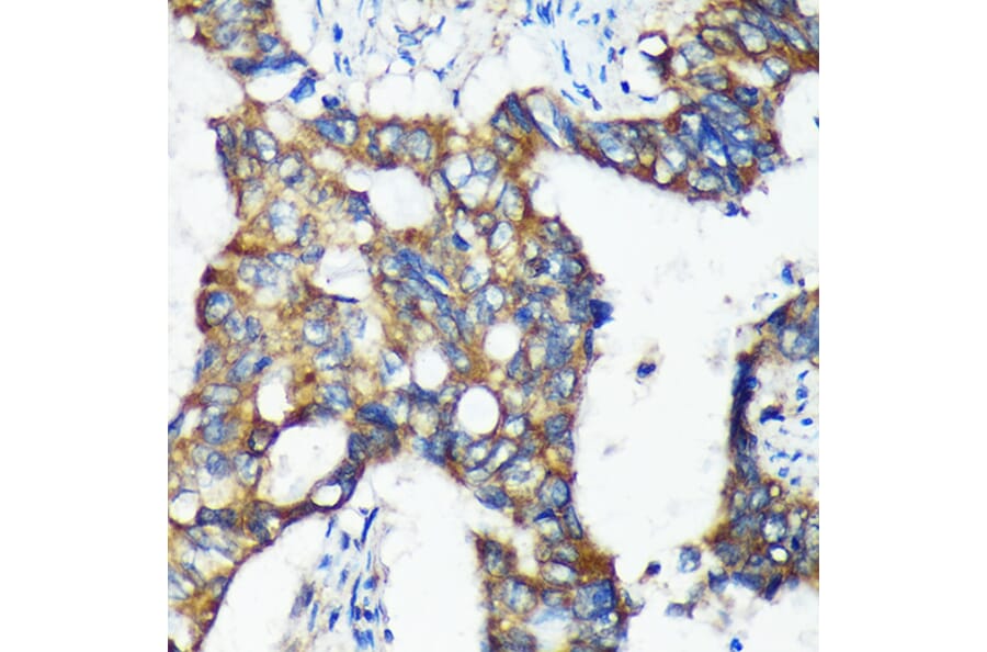 Immunohistochemistry - Anti-C18orf8 Antibody (A91124) - Antibodies.com