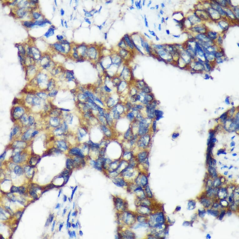 Immunohistochemistry - Anti-C18orf8 Antibody (A91124) - Antibodies.com