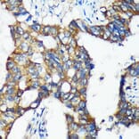 Immunohistochemistry - Anti-C18orf8 Antibody (A91124) - Antibodies.com