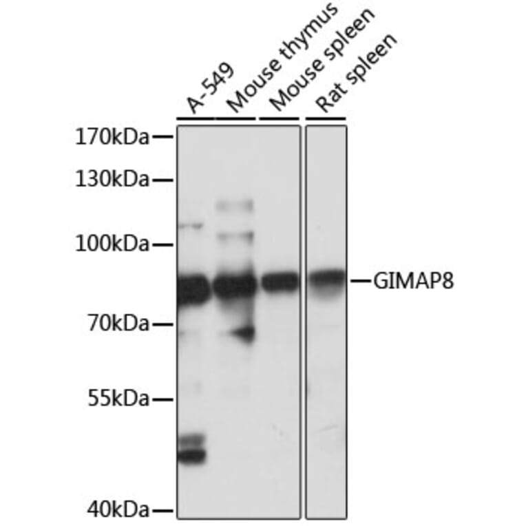 Western Blot - Anti-GIMAP8 Antibody (A91125) - Antibodies.com