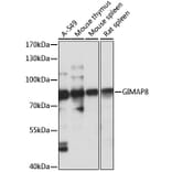 Western Blot - Anti-GIMAP8 Antibody (A91125) - Antibodies.com