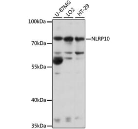 Western Blot - Anti-NLRP10 Antibody (A91126) - Antibodies.com