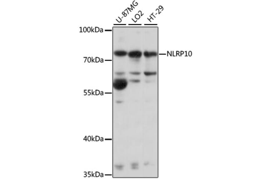 Western Blot - Anti-NLRP10 Antibody (A91126) - Antibodies.com
