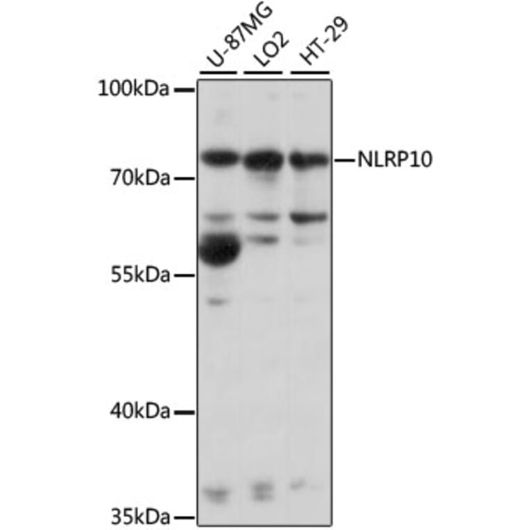 Western Blot - Anti-NLRP10 Antibody (A91126) - Antibodies.com