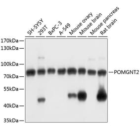 Western Blot - Anti-POMGNT2 Antibody (A91128) - Antibodies.com
