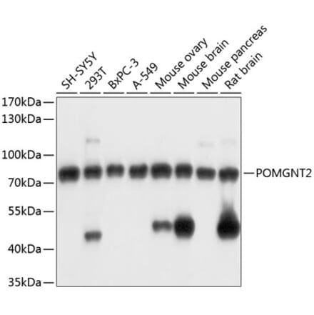 Western Blot - Anti-POMGNT2 Antibody (A91128) - Antibodies.com