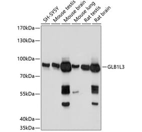 Western Blot - Anti-GLB1L3 Antibody (A91129) - Antibodies.com