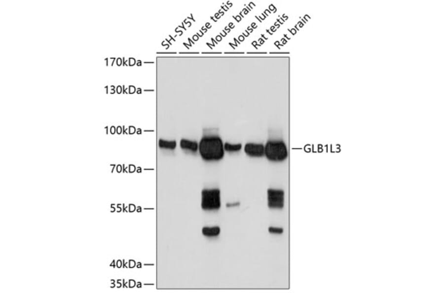 Western Blot - Anti-GLB1L3 Antibody (A91129) - Antibodies.com