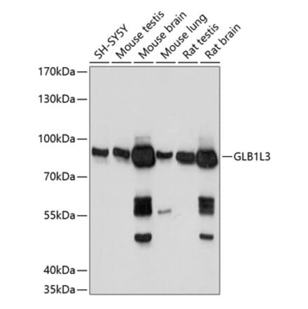 Western Blot - Anti-GLB1L3 Antibody (A91129) - Antibodies.com