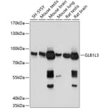 Western Blot - Anti-GLB1L3 Antibody (A91129) - Antibodies.com