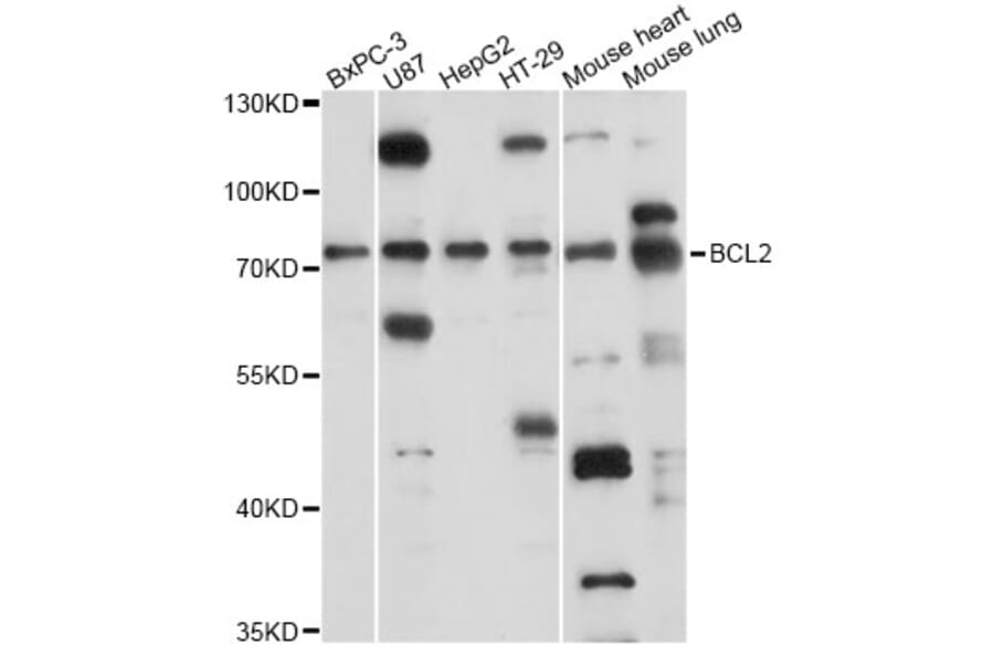 Western Blot - Anti-SLC37A2 Antibody (A14459) - Antibodies.com