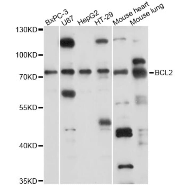 Western Blot - Anti-SLC37A2 Antibody (A14459) - Antibodies.com