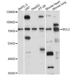Western Blot - Anti-SLC37A2 Antibody (A14459) - Antibodies.com
