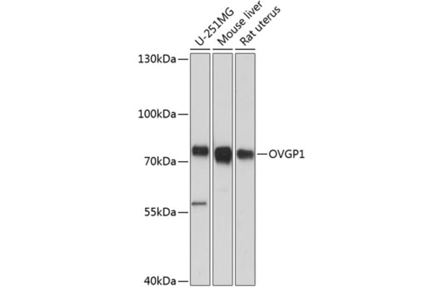 Western Blot - Anti-OVGP1/OGP Antibody (A91131) - Antibodies.com