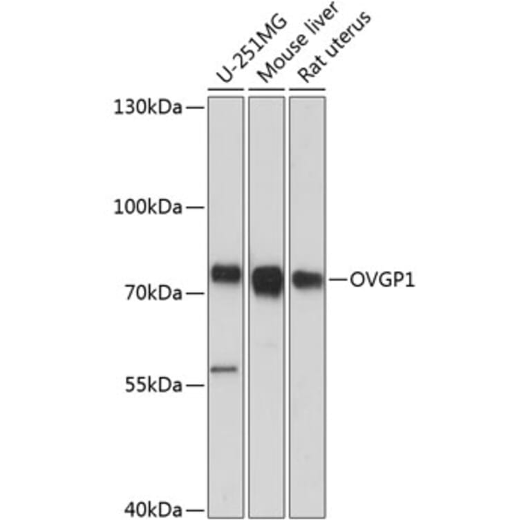 Western Blot - Anti-OVGP1/OGP Antibody (A91131) - Antibodies.com