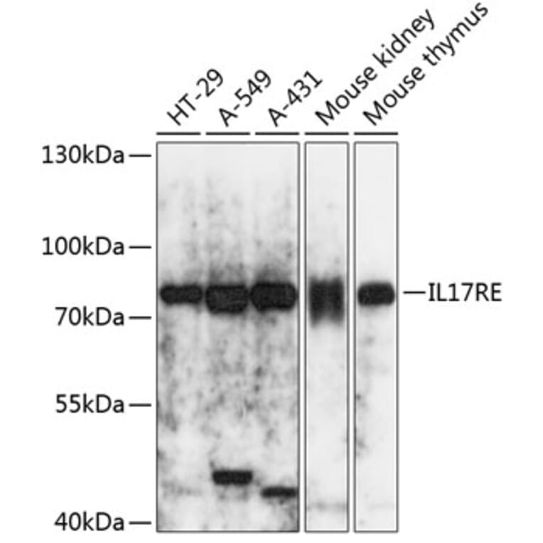 Western Blot - Anti-IL-17RE Antibody (A91132) - Antibodies.com