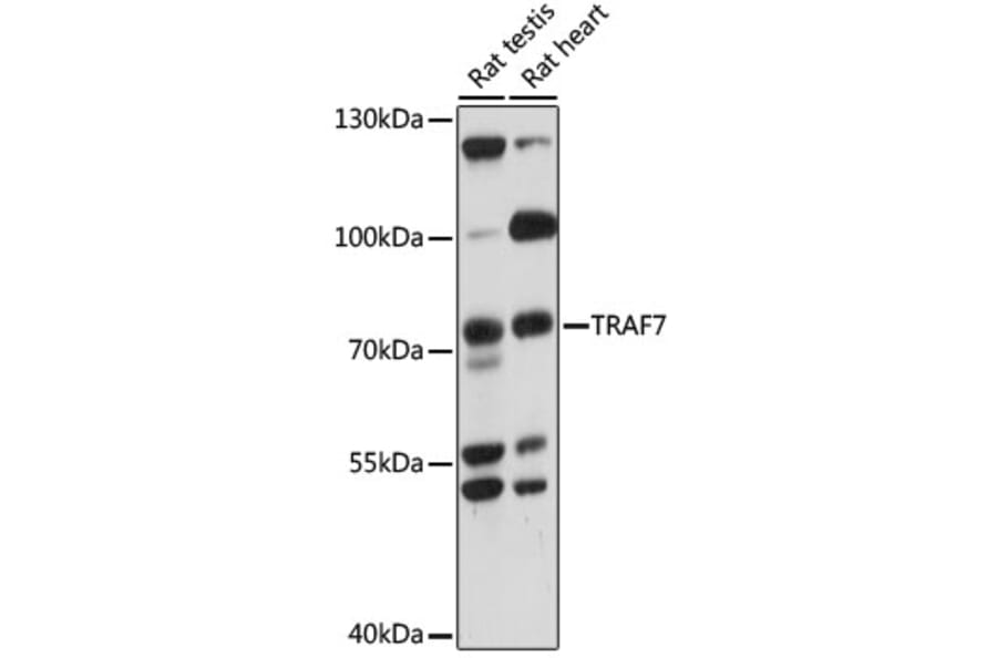 Western Blot - Anti-TRAF7 Antibody (A91134) - Antibodies.com