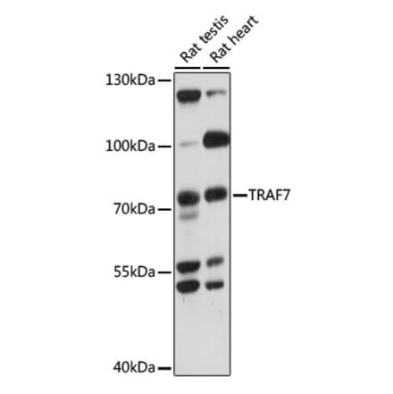 Western Blot - Anti-TRAF7 Antibody (A91134) - Antibodies.com