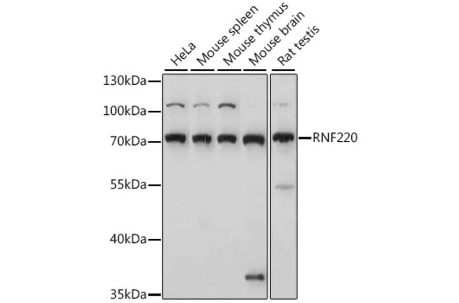 Western Blot - Anti-RNF220 Antibody (A91135) - Antibodies.com