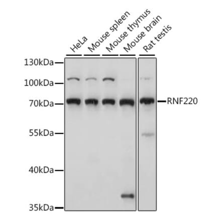 Western Blot - Anti-RNF220 Antibody (A91135) - Antibodies.com