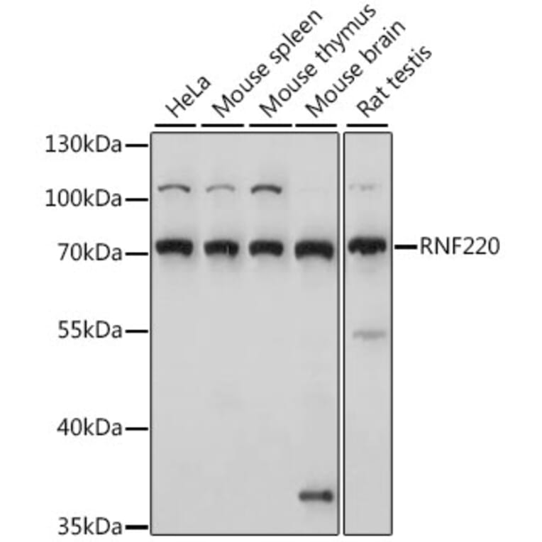 Western Blot - Anti-RNF220 Antibody (A91135) - Antibodies.com