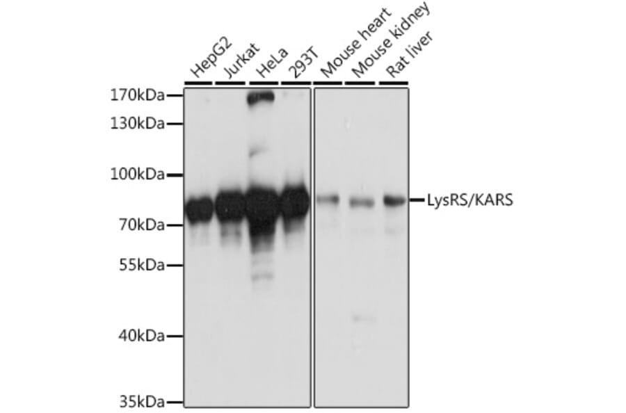 Western Blot - Anti-LysRS Antibody (A91138) - Antibodies.com